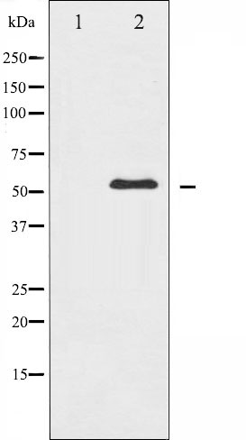 Western blot analysis of c-Abl expression in RAW264.7 whole cell lysates,The lane on the left is treated with the antigen-specific peptide.