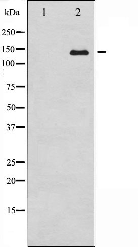 Western blot analysis of Abl expression in Adriamycin treated COS7 whole cell lysates,The lane on the left is treated with the antigen-specific peptide.