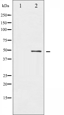 Western blot analysis of ATF2 expression in HeLa whole cell lysates,The lane on the left is treated with the antigen-specific peptide.
