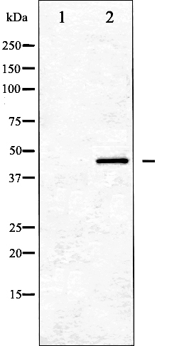 Western blot analysis of GATA1 expression in K562 whole cell lysates,The lane on the left is treated with the antigen-specific peptide.