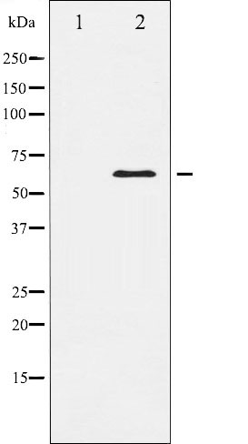 Western blot analysis of Elk1 expression in HeLa whole cell lysates,The lane on the left is treated with the antigen-specific peptide.