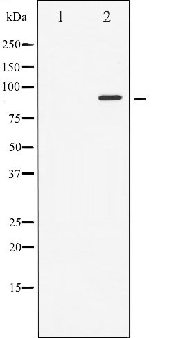Western blot analysis of STAT6 expression in HeLa whole cell lysates,The lane on the left is treated with the antigen-specific peptide.