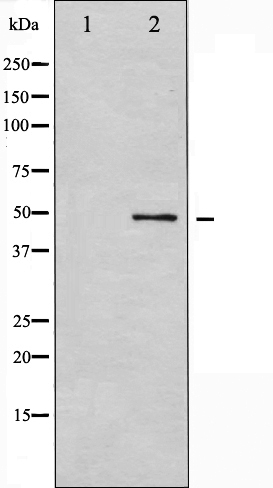 Western blot analysis of GSK3 alpha expression in ovarycancer whole cell lysates,The lane on the left is treated with the antigen-specific peptide.
