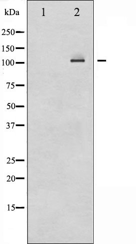 Western blot analysis of NF-kappaB p100/p52 expression in ovary cancer whole cell lysates,The lane on the left is treated with the antigen-specific peptide.