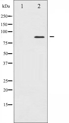 Western blot analysis of STAT4 expression in HeLa whole cell lysates,The lane on the left is treated with the antigen-specific peptide.