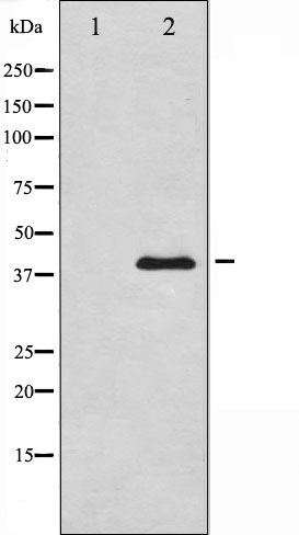 Western blot analysis of AMPK beta1 expression in COS7 whole cell lysates,The lane on the left is treated with the antigen-specific peptide.