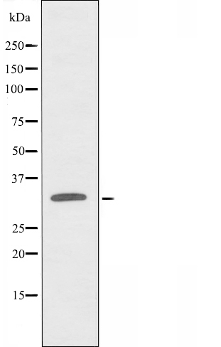 Western blot analysis of extracts from HeLa cells, using ZNF265 antibody.
