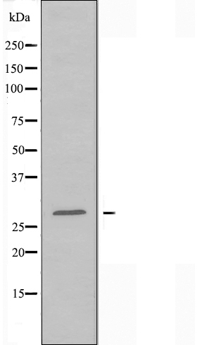 Western blot analysis of extracts from HepG2 cells using 14-3-3 beta antibody.