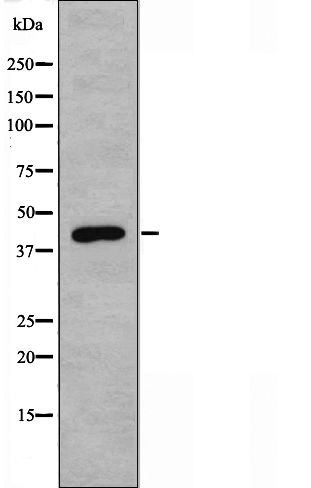 Western blot analysis of 5-HT-1A Antibody expression in HepG2 cells lysates.