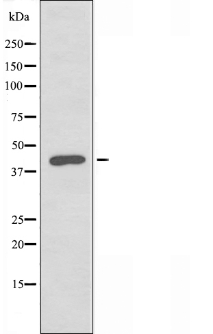 Western blot analysis of extracts from HeLa cells, using 5-HT-1E antibody.