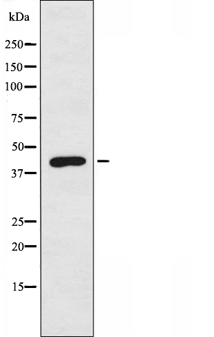 Western blot analysis of extracts from 293 cells, treated with insulin (0.01U/ml, 15mins), using 5-HT-4 antibody.