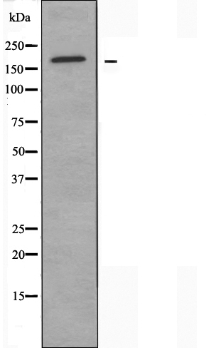 Western blot analysis of extracts from HeLa cells using ABCC3 antibody.