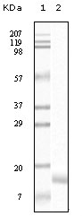 Figure 1: Western blot analysis using SNCG mouse mAb against truncated SNCG recombinant protein.