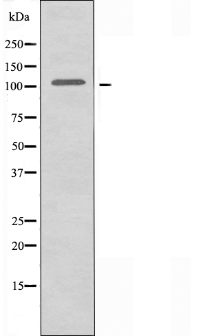 Western blot analysis of extracts from HepG2 cells, using ZZZ3 antibody.