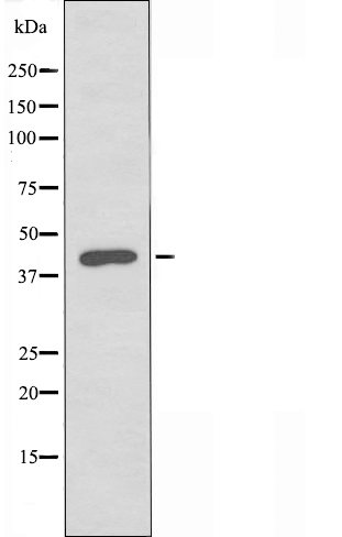 Western blot analysis of extracts from COS7 cells, using ZDHHC2 antibody.