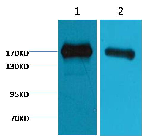 Western blot analysis of EGFR Antibody expression in A431 and Caco-2 cells lysates.
