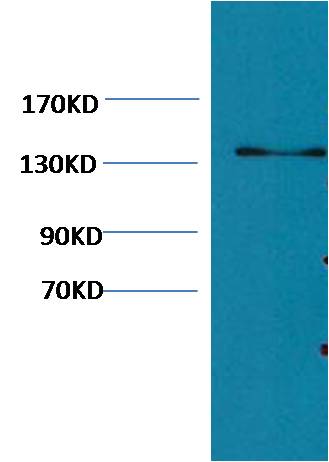 Western blot analysis of Hela with Collagen III Mouse mAb diluted at 1:1,000.