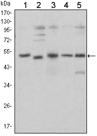 Figure 1: Western blot analysis using SMAD5 mouse mAb against Hela (1), SK-N-SH (2), PC-12 (3), Jurkat (4), and K562 (5) cell lysate.
