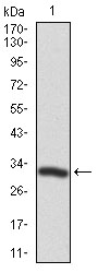 Figure 1: Western blot analysis using TWF1 mAb against human TWF1 recombinant protein. (Expected MW is 31.1 kDa)