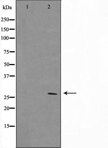Western blot analysis on MCF7 cell lysate using BCL-2 Antibody,The lane on the left is treated with the antigen-specific peptide.