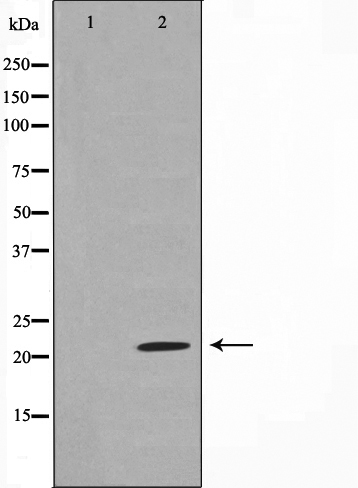 Western blot analysis on rat liver cell lysate using Claudin 7 Antibody,The lane on the left is treated with the antigen-specific peptide.