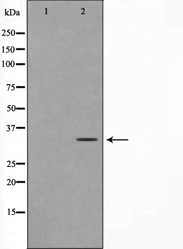 Western blot analysis on HeLa cell lysate using ZNF265 Antibody,The lane on the left is treated with the antigen-specific peptide.