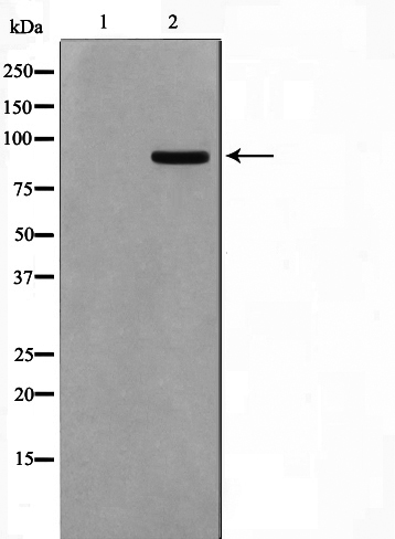 Western blot analysis on COS7 cell lysate using AAK1 Antibody,The lane on the left is treated with the antigen-specific peptide.