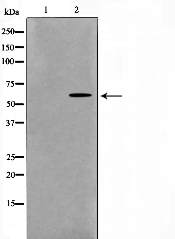 Western blot analysis on 293 cell lysate using GK Antibody,The lane on the left is treated with the antigen-specific peptide.