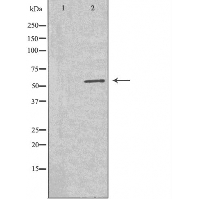 Western blot analysis of extracts from 293 cells using GLPK antibody.The lane on the left is treated with the antigen-specific peptide.