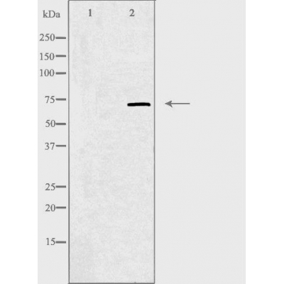 Western blot analysis of extracts from K562 cells, using ZNF147 antibody.The lane on the left is treated with the antigen-specific peptide.