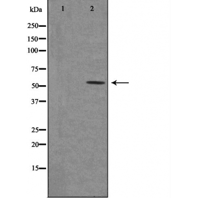 Western blot analysis of extracts from rat brain cells, using 5-HT-2C antibody.The lane on the left is treated with the antigen-specific peptide.