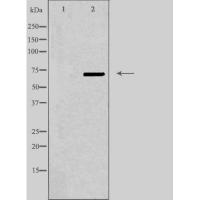 Western blot analysis of extracts from HepG2 cells, using ABCD4 antibody.The lane on the left is treated with the antigen-specific peptide.