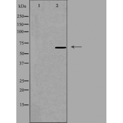 Western blot analysis of extracts from HeLa cells using RED antibody.The lane on the left is treated with the antigen-specific peptide.
