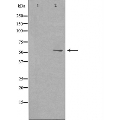 Western blot analysis of extracts from HeLa cells using HTR2B antibody.The lane on the left is treated with the antigen-specific peptide.