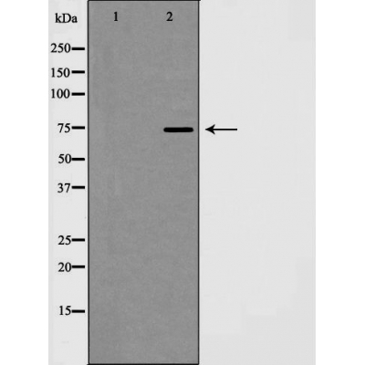 Western blot analysis of T-cadherin expression in HT29 cell lysate,The lane on the left is treated with the antigen-specific peptide.