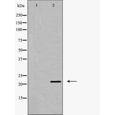 Western blot analysis of Claudin 11 expression in Mouse brain extract.The lane on the left is treated with the antigen-specific peptide.