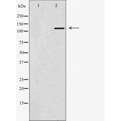 Western blot analysis of Hela whole cell lysates, using ABL1 Antibody. The lane on the left is treated with the antigen-specific peptide.