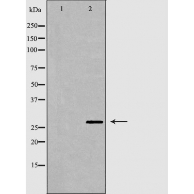 Western blot analysis of Hela whole cell lysates, using SFN Antibody. The lane on the left is treated with the antigen-specific peptide.