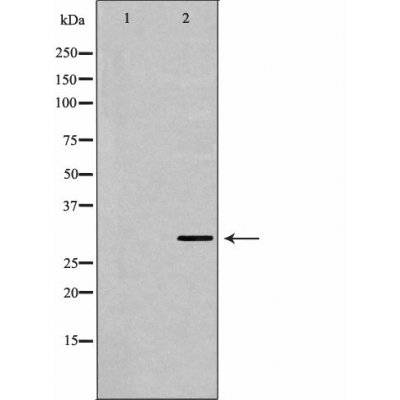 Western blot analysis of Hela whole cell lysates, using YWHAE Antibody. The lane on the left is treated with the antigen-specific peptide.