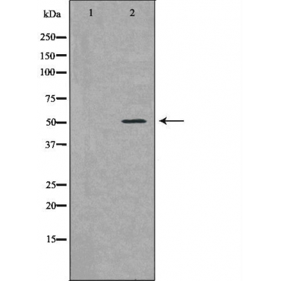 Western blot analysis of Jurkat lysate using BCL2L13 antibody. The lane on the left is treated with the antigen-specific peptide.