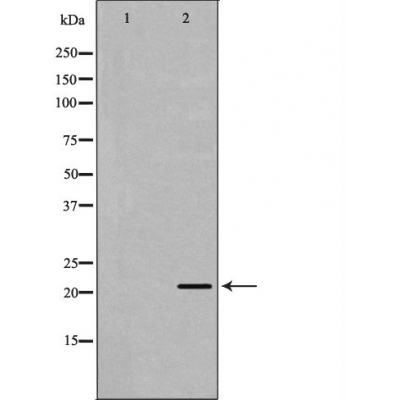 Western blot analysis of HL-60 lysate using BCL2L2 antibody. The lane on the left is treated with the antigen-specific peptide.