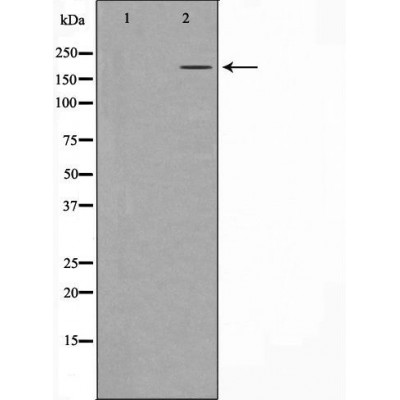 Western blot analysis of extracts of A431 , using TET1 antibody. The lane on the left is treated with the antigen-specific peptide.