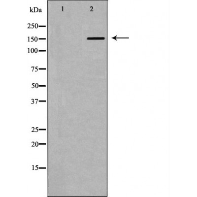 Western blot analysis of extracts of HepG2, using A2M antibody. The lane on the left is treated with the antigen-specific peptide.