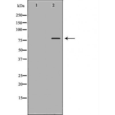 Western blot analysis of extracts of A549, using ABCG8antibody. The lane on the left is treated with the antigen-specific peptide.