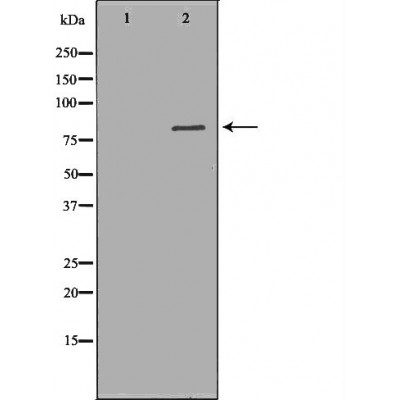 Western blot analysis of extracts of HepG2, using ALOX5 antibody. The lane on the left is treated with the antigen-specific peptide.