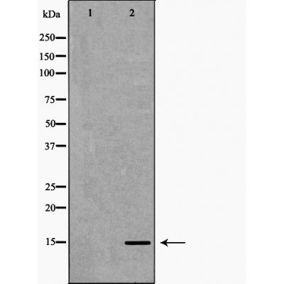 Western blot analysis of extracts of HeLa using Histone H3 antibody. The lane on the left is treated with the antigen-specific peptide.