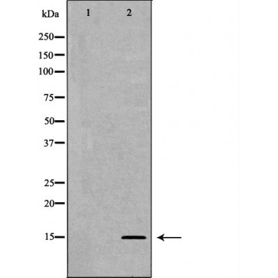 Western blot analysis of extracts of HeLa using H3K27me2 antibody. The lane on the left is treated with the antigen-specific peptide.