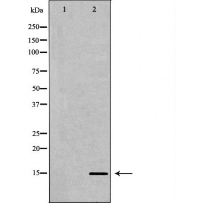 Western blot analysis of extracts of HeLa using H3K27me3 antibody. The lane on the left is treated with the antigen-specific peptide.