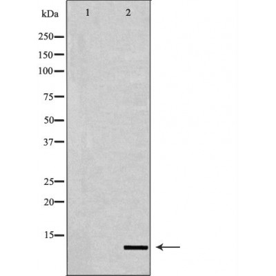 Western blot analysis of extracts of HeLa using H4K20me2 antibody. The lane on the left is treated with the antigen-specific peptide.