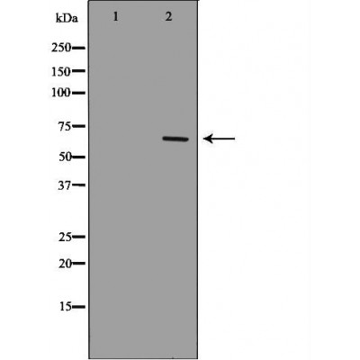 Western blot analysis of extracts of Jurkat , using p65 antibody. The lane on the left is treated with the antigen-specific peptide.